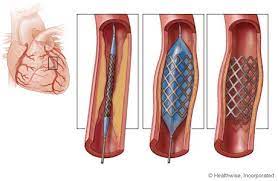 To connect with esperance de vie, join facebook today. Apprenez A Dire Non A Votre Cardiologue Sante Corps Esprit