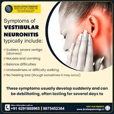 Image result for Vestibular Neuronitis