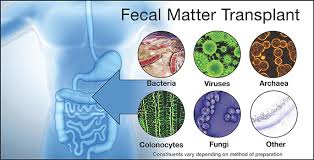 Image result for Fecal Transfer