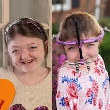 Abby's Journey with Pfeiffer Syndrome