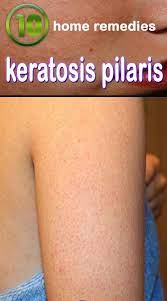 Pin By Michel Quinones On Healthy Recipes To Make Remedies Home Remedies Natural Health Care
