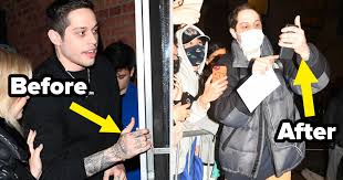And not just any tattoos: Pete Davidson Reportedly Removing All Of His Tattoos