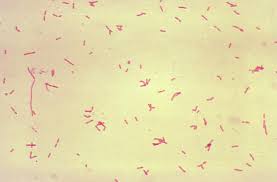 Image result for Bacteroidaceae