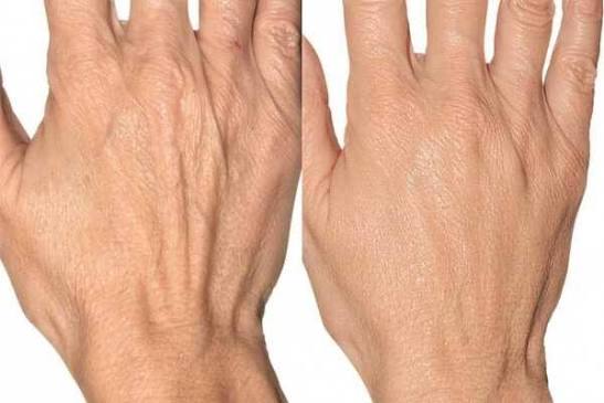 Hand appearance and overall wellness