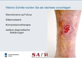 +34 93 774 51 60. Behandlung Von Hautlasionen An Den Beinen Bei Chron Venoser Insuffizienz Und Anderen Ursachen Pdf Free Download