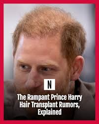For years, Prince Harry couldn't hide ...