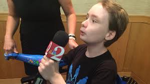 Photos: Boy receives Blue Man Group arm