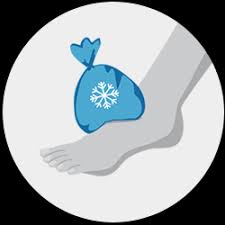 Das blut kann auch in vorbestehende körperhöhlen austreten. Prellung Verstauchung Bluterguss Was Hilft Klosterfrau