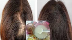 The sooner you find the cause, the better your chance of getting results you want. 10 Amazing Benefits Of Onion For Hair Growth Sassilicious