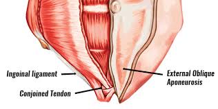 Image result for Groin Disruption