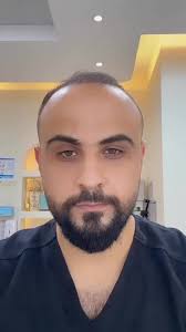 نقاط حقن البوتوكس المهم تتتعرفي عليها وتعرفي الفرق بين رفع الحاجب او سحب  الحاجب #botox #filler #beauty #دبي #تجميل_الوجه