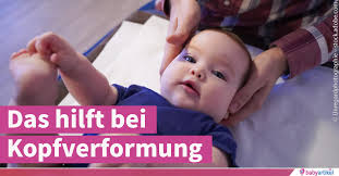 Ein platter hinterkopf ist bei babys keine seltenheit. Schiefkopf Und Plattkopf Beim Baby Das Hilft Bei Kopfverformung