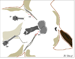 Lateral recumbent position discover free flashcards, games, and test prep activities designed to help you learn about lateral recumbent position and other concepts. Showing The Animal Laid In Right Lateral Recumbent Position With The Download Scientific Diagram