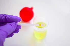 .жидкости (total protein in urine/cerebrospinal fluid (u/csf protein) roche/hitachi). Protein In Urine During Pregnancy What Does It Mean