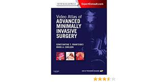 Video Atlas Of Advanced Minimally Invasive Surgery Expert Consult Online And Print 9781437727234 Medicine Health Science Books Amazon Com
