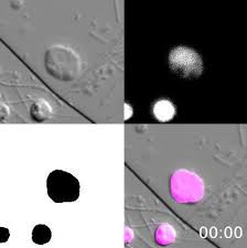 Animal development, the processes that lead eventually to the formation of a new animal starting from cells derived from one or more parent individuals. A Flagellate To Amoeboid Switch In The Closest Living Relatives Of Animals Elife
