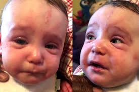 Please Care About My Child's Food Allergy