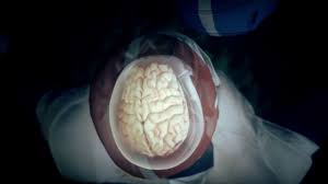 Adalet bakanlığı kura sonuçları açıklandı. Cte How Repeated Head Blows Affect The Brain Youtube