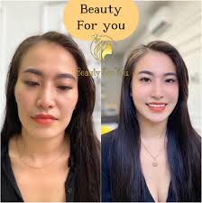 Oseba Dookdik ຢາກຂາຍຖືກ je dodala novo...