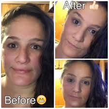 What products cover redness and dark spots?