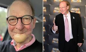 John Blackman: Hey Hey It's Saturday star dies at the age of 76 after  harrowing battle with cancer and major surgery to remove his jaw