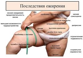 книга агафонова как похудеть за 28 дней читать онлайн Kniga Kak Pohudet Za 28 Dnej Ili O Chyom Molchat Vrachi I Dietologi Info Cast Ru