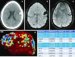 As a former english teacher, i know of no rule suggesting one or the other. 1 Patient Is A 20 Year Old Male Admitted To The Hospital For 30 Ft Download Scientific Diagram