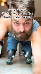 Limb Loss Boss Official...