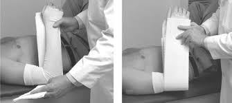 Maybe you would like to learn more about one of these? Adult Forearm Fractures Orthoinfo Aaos