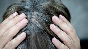 ruyada saclarin beyazlamasi ruyada sacini boyatmak tabiri