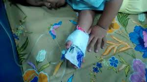 Anak2 Di Infus Youtube
