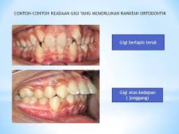 Share pada group whatsapp makcik pakcik kita , makayah kita, yang selalu kena pergi ke klinik setiap dua atau tiga bulan tu. Wah Pejabat Kesihatan Pergigian Daerah Kuala Krai Facebook