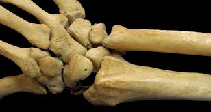 Its not option a because a foramen is a hole in a bone not a mark. Short Bone Wikipedia