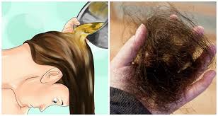 Rambut rontok jika dibiarkan bisa mengakibatkan risiko kebotakan. Cara Mengatasi Rambut Rontok Pada Anak