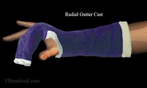 We did not find results for: Radial Gutter Cast