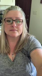 Sharon Woolridge Amputee