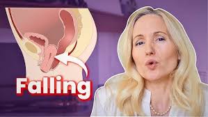 Pelvic Floor Q&A Live with Denise Conway