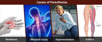 Image result for Paresthesia