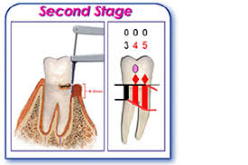 Diagnosis And Images Of Gum Disease