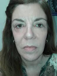 EDITORIAL Martínez G VERSATILIDAD DEL COLGAJO TRIPIER Cruz Mantilla DC y  cols. GENITOPLASTIA FEMINIZANTE Mackfarlane M y cols.