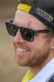 Vital MX Pit Bits: Unadilla