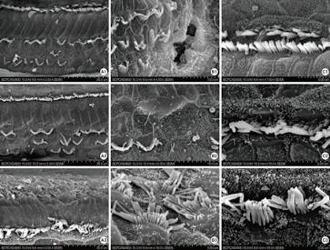 Cochlear Hair Cells: When these micro-receptors degrade, they trigger a cascade of chaotic signals to the brain., AI generated