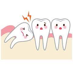 Medical wisdom tooth dentists dental surgeon dental surgeons dental surgery surgeries dental surgeries patient patients dentist teeth wisdom teeth health surgery pulling teeth tooth extraction. What You Need To Know About Extracting Your Wisdom Teeth All Star Dental