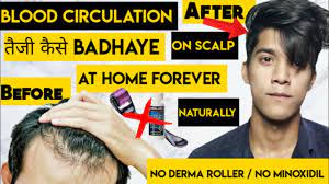 Medical health screening for hair loss may include blood tests such as complete blood and hats don't choke off the circulation to the scalp to cause hair loss either. How To Increase Blood Circulation On Scalp For Hair Growth Hair Regrowth By Blood Circulation Youtube
