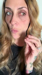 6 hours later & no improvement…..I did indeed end up having to take a  bennie & then I sure did take a nap😴………a cold compress makes it feel  better but doesn’t lessen the swelling🫠 because I am allergic ...