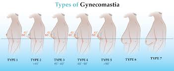 This comprises only a part of the total cost. Male Breast Reduction Got Man Boobs Cost Recovery Etc