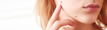 4 août 2019 à 21h03. Micro Chirurgie Et Dermatologie Cshp Paris