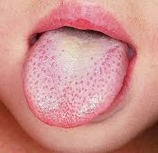 أبو عبد الله جعفر بن محمد الصادق، (ولد يوم 17 ربيع الأول 80 هـ في المدينة المنورة وتوفي فيها في مساء 25 شوال من سنة 148 هـ)، إمام من أئمة المسلمين وعالم جليل وعابد فاضل من ذرية الحسين بن علي بن أبي طالب وله مكانة جليلة عظيمة. Ù…Ø´ Ø¨Ø³ Ù„Ù„Ø±ØºÙ‰ ÙˆØªØ°ÙˆÙ‚ Ø§Ù„Ø·Ø¹Ø§Ù… Ø§Ø¹Ø±Ù Ù…Ø±Ø¶Ùƒ Ù…Ù† Ù„ÙˆÙ† Ù„Ø³Ø§Ù†Ùƒ Ø§Ù„ÙˆØ±Ø¯ÙŠ Ø¹Ù„Ø§Ù…Ø© Ø§Ù„ØµØ­Ø© ÙˆØ§Ù„Ø£Ø±Ø¬ÙˆØ§Ù†ÙŠ ÙŠØ­Ø°Ø±Ùƒ Ù…Ù† Ù…Ø´Ø§ÙƒÙ„ Ø¨Ø§Ù„Ù‚Ù„Ø¨ Ø§Ù„Ø£ØµÙØ± Ø¹Ù„Ø§Ù…Ø© Ù„Ù„ØµØ¯ÙÙŠØ© Ùˆ Ø§Ù„Ø±Ù…Ø§Ø¯ÙŠ Ù…Ø±ØªØ¨Ø· Ø¨Ø§Ù„Ø¥ÙƒØ²ÙŠÙ…Ø§ Ø§Ù„Ø£Ø²Ø±Ù‚ Ø¯Ù„ÙŠÙ„ Ù†Ù‚Øµ Ø§Ù„Ø£ÙƒØ³Ø¬ÙŠÙ† ÙˆØ§Ù„Ø£Ø³ÙˆØ¯ Ø¨ÙŠÙ‚ÙˆÙ„Ùƒ Ø³ÙƒØ±Ùƒ