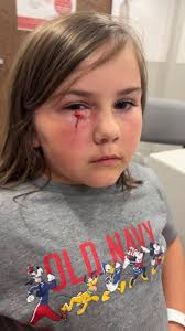 Woman and dog attacked with fireworks