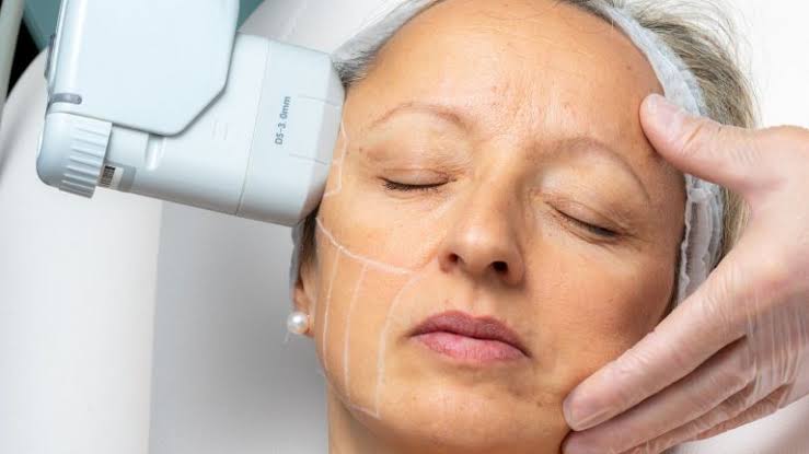 Understanding Linear HIFU vs. Dot HIFU: Key Differences and the Importance  of Genuine Brands - Sparsh Skin Clinic